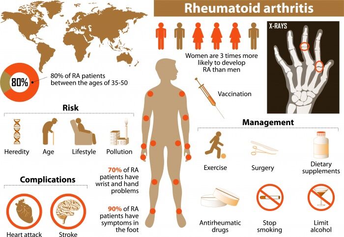 semaglutide cause depression Semaglutide is associated with a 44% decreased risk of depression and a 38%  decreased risk of anxiety